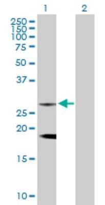 Western Blot: CLTB Antibody [H00001212-D01P]