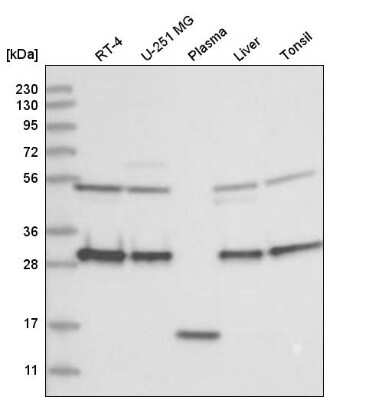 Western Blot: CLTB Antibody [NBP2-55390]