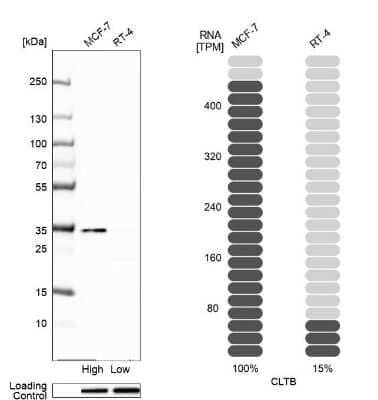 Western Blot: CLTB Antibody [NBP2-55390]