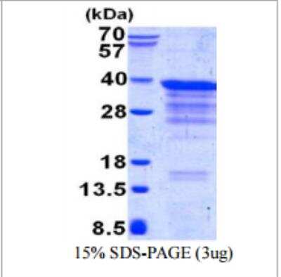 SDS-PAGE: Recombinant Human CLTB His Protein [NBP1-98874]