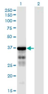 Western Blot: CLUAP1 Antibody (6E12) [H00023059-M05]