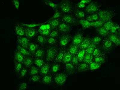 Immunocytochemistry/ Immunofluorescence: CLUAP1 Antibody [NBP3-06085]