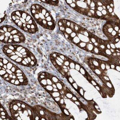 Immunohistochemistry-Paraffin: CLUAP1 Antibody [NBP1-84734]