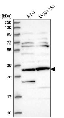 Western Blot: CLUAP1 Antibody [NBP2-58124]