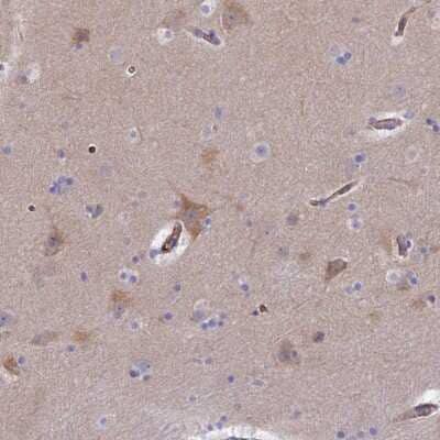 Immunohistochemistry: CLVS2 Antibody [NBP2-47504]