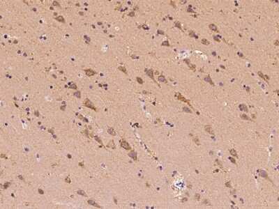 Immunohistochemistry-Paraffin: CLVS2 Antibody [NBP2-97429]