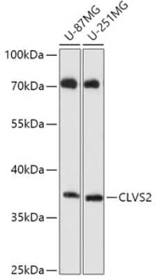 Western Blot: CLVS2 AntibodyAzide and BSA Free [NBP2-92386]