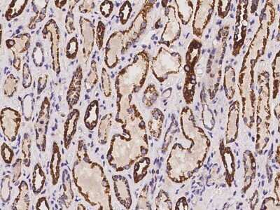 Immunohistochemistry-Paraffin: CLYBL Antibody [NBP2-97982]