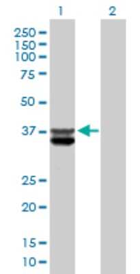 Western Blot: CLYBL Antibody [H00171425-B01P]