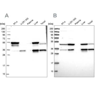 Western Blot: CLYBL Antibody [NBP1-84453]