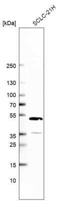 Western Blot: CLYBL Antibody [NBP1-84454]