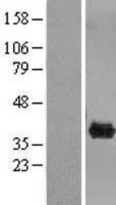 Western Blot: CLYBL Overexpression Lysate [NBL1-09292]