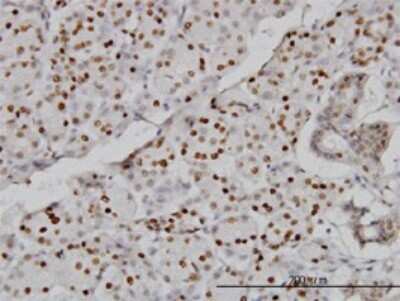 Immunohistochemistry-Paraffin: CMAS Antibody (5A2) [H00055907-M01]