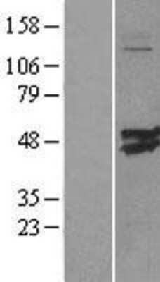 Western Blot: CMAS Overexpression Lysate [NBL1-09294]