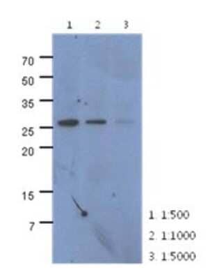 Western Blot: CMBL Antibody (2B11)BSA Free [NBP2-22618]