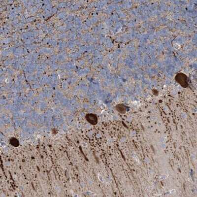 Immunohistochemistry-Paraffin: CMBL Antibody [NBP1-82069]