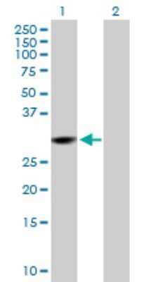 Western Blot: CMBL Antibody [H00134147-B01P]