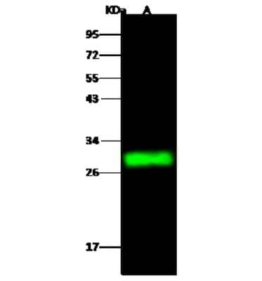 Western Blot: CMBL Antibody [NBP2-99788]