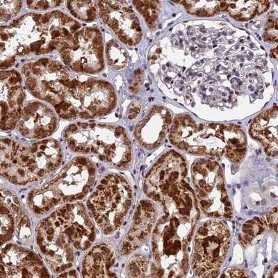 Immunohistochemistry-Paraffin: CMC1 Antibody [NBP1-86786]