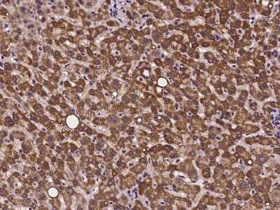 Immunohistochemistry-Paraffin: CMC1 Antibody [NBP2-97239]