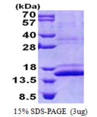 SDS-PAGE: Recombinant Human CMC1 His Protein [NBP2-22801]