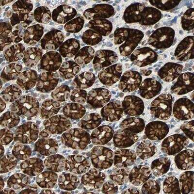 Immunohistochemistry-Paraffin: CMC2 Antibody [NBP1-85289]