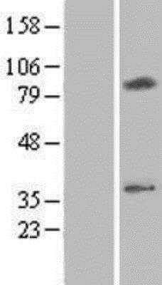 Western Blot: CMC2 Overexpression Lysate [NBP2-06681]