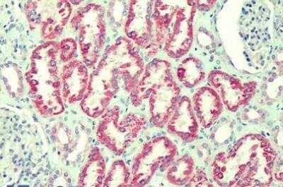 Immunohistochemistry-Paraffin: CMG-2/ANTXR2 Antibody [NBP1-49866]