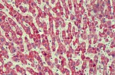 Immunohistochemistry-Paraffin: CMG-2/ANTXR2 Antibody [NBP1-49866]