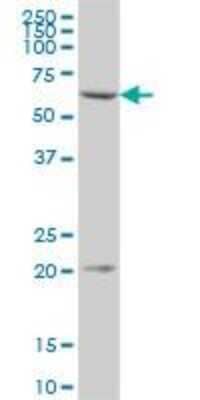 Western Blot: CMG-2/ANTXR2 Antibody [H00118429-B01P]