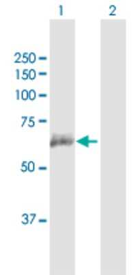 Western Blot: CMG-2/ANTXR2 Antibody [H00118429-B01P]