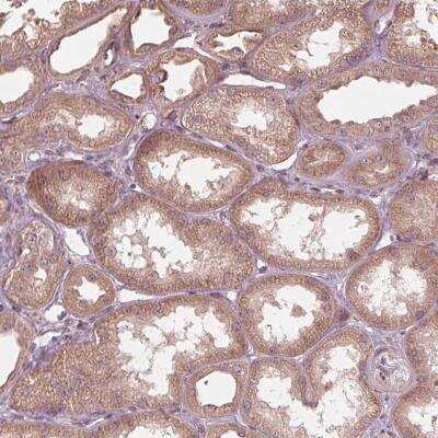 Immunohistochemistry-Paraffin: CMIP Antibody [NBP2-56410]