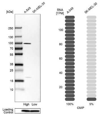 Western Blot: CMIP Antibody [NBP2-56410]