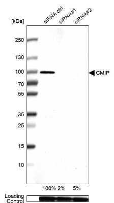 Western Blot: CMIP Antibody [NBP2-56410]