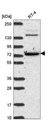 Western Blot: CMIP Antibody [NBP2-58180]