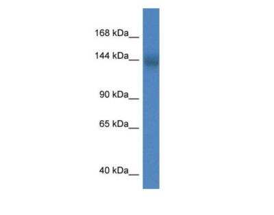 Western Blot: CMIP2 Antibody [NBP3-06878]