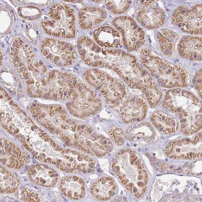 Immunohistochemistry-Paraffin: ChemR23/CMKLR1 Antibody [NBP2-13847]