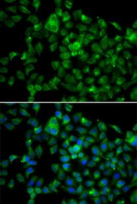 Immunocytochemistry/ Immunofluorescence: CML2 Antibody - BSA Free [NBP3-03797]