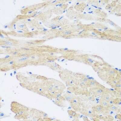 Immunohistochemistry-Paraffin: CML2 Antibody - BSA Free [NBP2-92803]