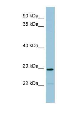 Western Blot: CML2 Antibody [NBP1-60012]