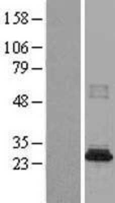 Western Blot: CML2 Overexpression Lysate [NBL1-13492]