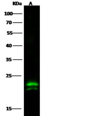 Western Blot: CMP kinase Antibody (08) [NBP3-06539]