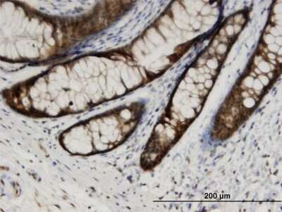 Immunohistochemistry-Paraffin: CMP kinase Antibody (1D7) [H00051727-M03]