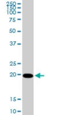 Western Blot: CMP kinase Antibody (1D7) [H00051727-M03]