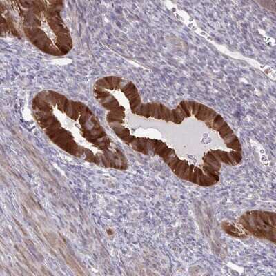 Immunohistochemistry: CMP kinase Antibody [NBP2-33692]
