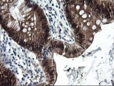 Immunohistochemistry: CMP kinase Antibody (OTI1A1) - Azide and BSA Free [NBP2-71947]