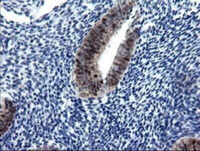 Immunohistochemistry: CMP kinase Antibody (OTI1A1) - Azide and BSA Free [NBP2-71947]