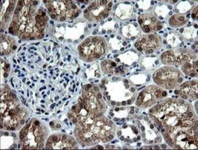 Immunohistochemistry: CMP kinase Antibody (OTI1A1) - Azide and BSA Free [NBP2-71947]