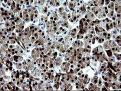 Immunohistochemistry: CMP kinase Antibody (OTI1A1) - Azide and BSA Free [NBP2-71947]