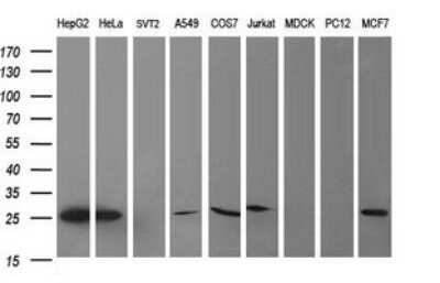 Western Blot: CMP kinase Antibody (OTI1A1)Azide and BSA Free [NBP2-71947]